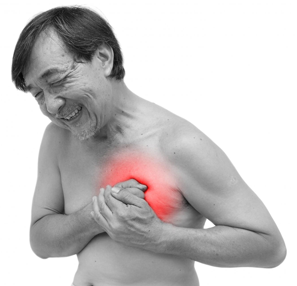 Bilde av mann med hjertesykdom